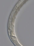 Holotype male posterior end of Antomicron quindecimpapillatus