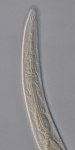 Paratype female anterior end of Antomicron quindecimpapillatus