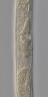 Paratype female midbody of Antomicron quindecimpapillatus