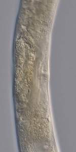 Paratype female midbody of Deontolaimus catalinae