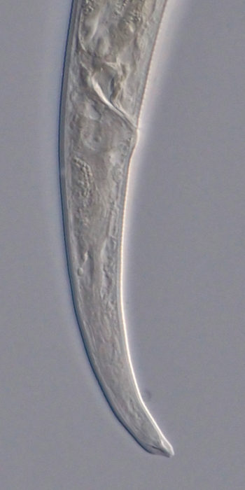 Paratype female posterior of Deontolaimus catalinae