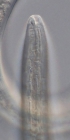 Paratype female anterior end of Deontolaimus timmi