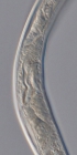 Paratype female midbody of Deontolaimus timmi