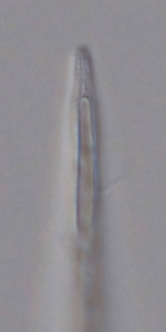 Holotype male anterior end of Leptolaimoides filicaudatus