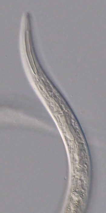 Paratype female anterior end of Leptolaimoides filicaudatus
