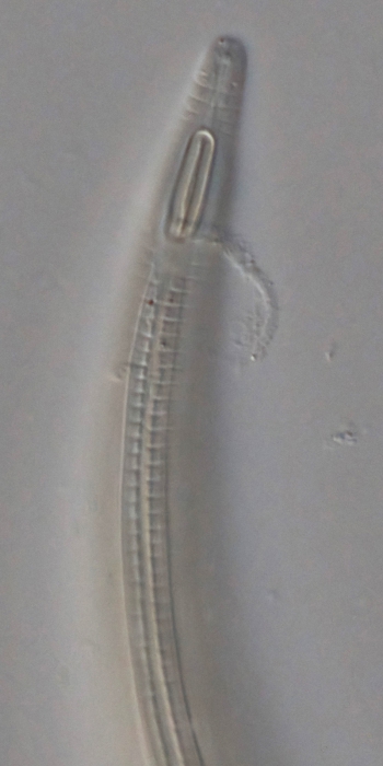 Holotype male anterior end of Leptolaimoides leptomicron