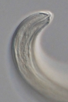 Holotype female anterior end of Loveninema tubulosa