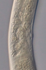 Holotype female midbody of Loveninema tubulosa