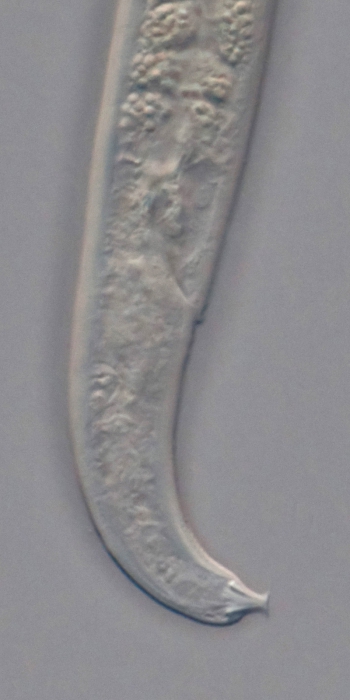 Holotype female posterior end of Loveninema tubulosa