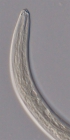 Paratype male anterior end of Loveninema tubulosa