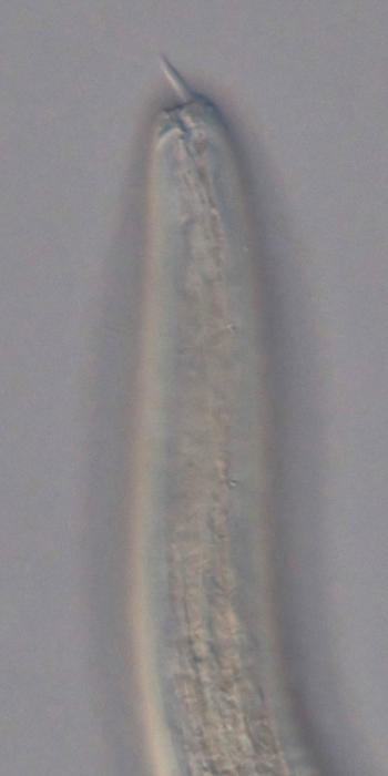 Holotype female anterior end of Loveninema unicornis
