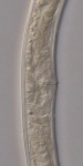 Holotype female midbody of Loveninema unicornis