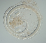 Female specimen of Onchium ocellatum inside the host