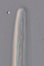Holotype male anterior end of Setostephanolaimus tchesunovi