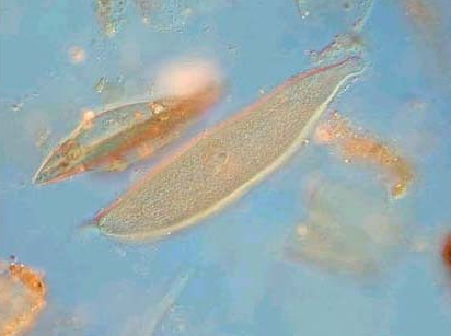 Ciliata Ciliata