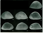 Abyssobairdia -  SEM photos from Coles & Whatley, 1989