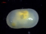 Cytherellidae