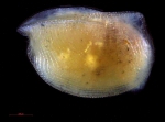 Ostracoda (seed shrimp)