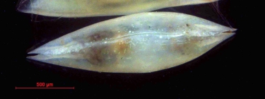 Macrocypria sarsi - dorsal view