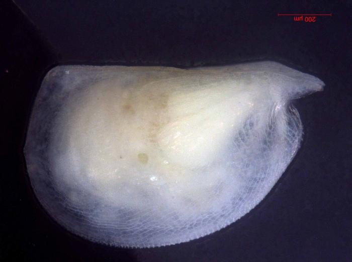 Mikroconchoecia stigmatica