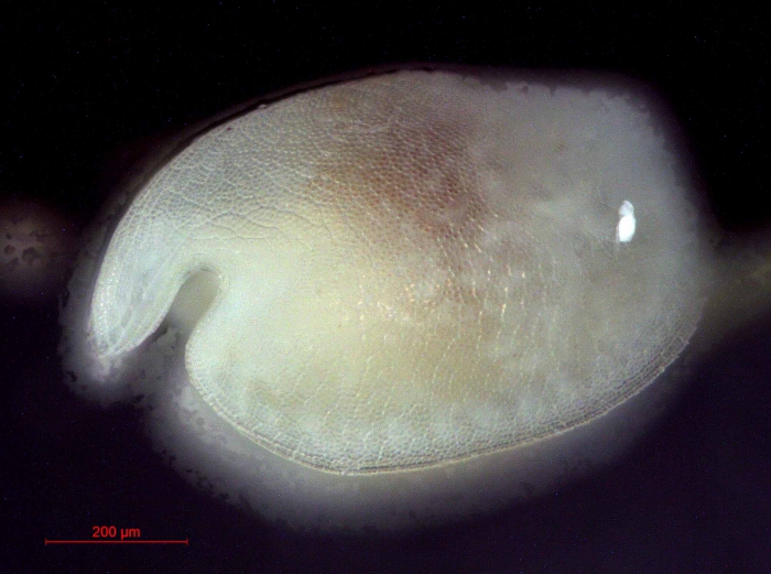 A Bathyconchoecia species