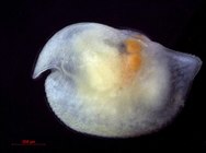 Bathyconchoecia