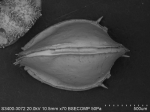 Ostracoda (seed shrimp)