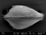 Ostracoda