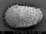 Legitimocythere from the Southern Ocean