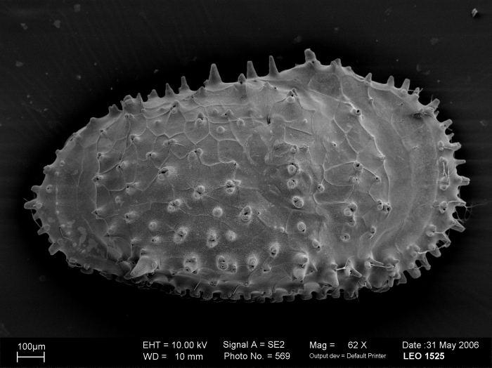Cytherocopina (Suborder) Cytheroidea (Superfamily) Trachyleberididae (Family) Legitimocythere Cytherocopina (Suborder) Cytheroidea (Superfamily) Trachyleberididae (Family) Legitimocythere