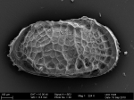 Ostracoda