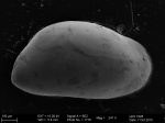 Ostracoda