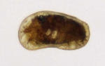 Ostracoda (seed shrimp)