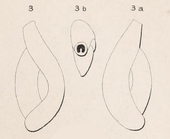 Triloculina dubia d'Orbigny in Fornasini, 1905