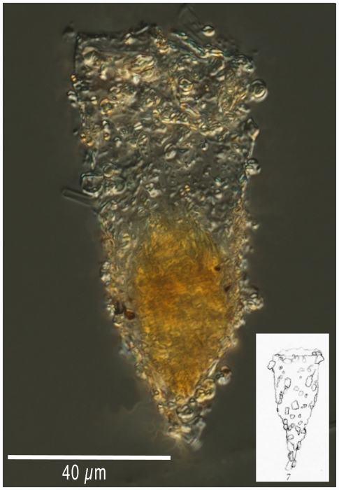 Tintinnopsis fennica Tintinnopsis fennica