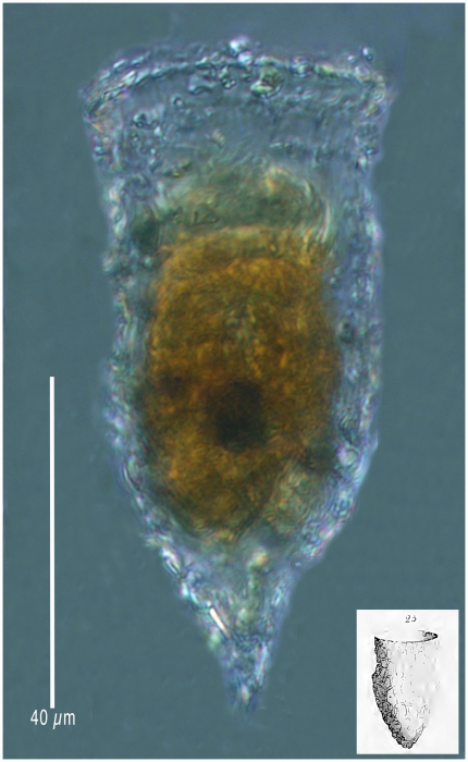 Tintinnopsis vasuculm Tintinnopsis vasuculm