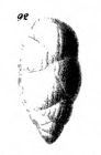 Uvigerina gemmaeformis Schwager, 1866