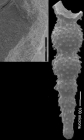 Stilostomella bortanica Hornibrook, 1961, topotype