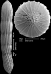 Chromista - Foraminifera (foraminifers)