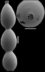 Lotostomoides schwageri Hayward, 2012 PARATYPE