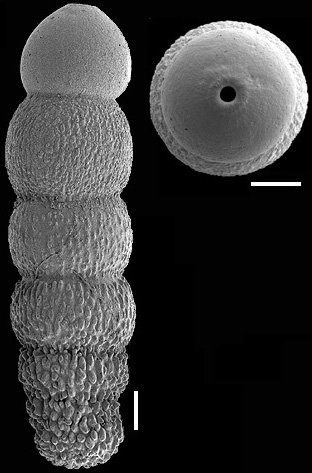 Glandulonodosaria trincherasensis (Bermudez, 1949) IDENTIFIED SPECIMEN Glandulonodosaria trincherasensis (Bermudez, 1949) IDENTIFIED SPECIMEN