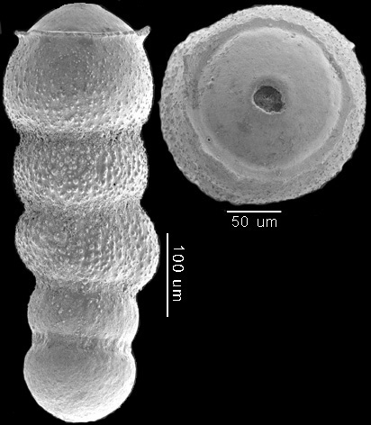 Glandulonodosaria trincherasensis (Bermudez, 1949) IDENTIFIED SPECIMEN Glandulonodosaria trincherasensis (Bermudez, 1949) IDENTIFIED SPECIMEN