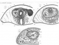 Acoelomorpha (acoelomorphs)