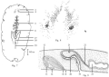 Platyhelminthes (flatworms)