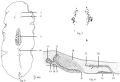 Platyhelminthes (flatworms)