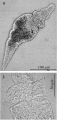 Platyhelminthes (flatworms)