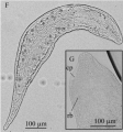 Platyhelminthes (flatworms)