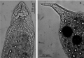 Platyhelminthes (flatworms)