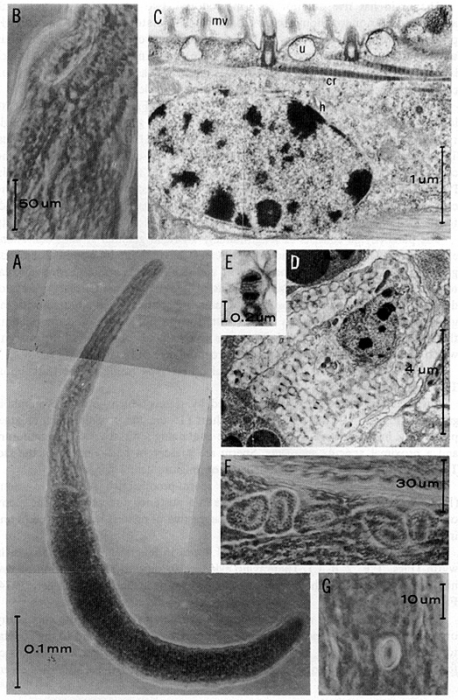 Retronectes atypica