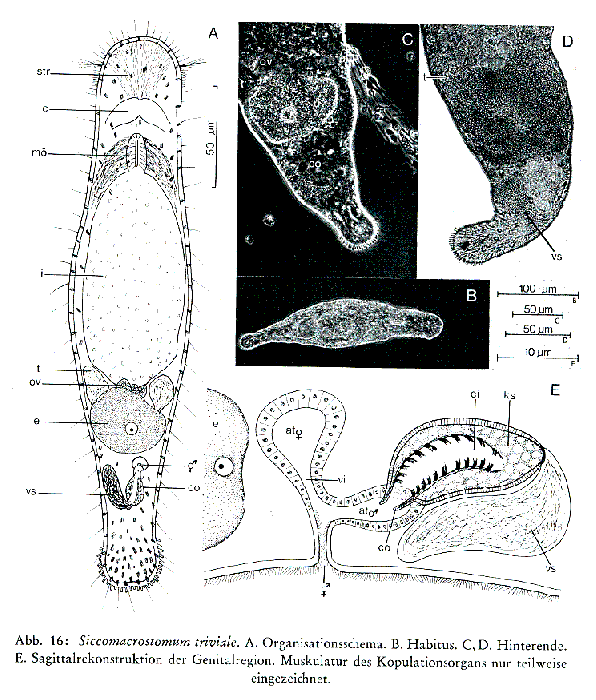 Siccomacrostomum triviale